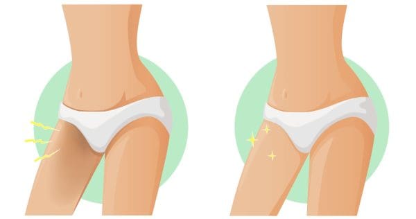 تجربتي مع معجون الأسنان للمنطقة الحساسة
